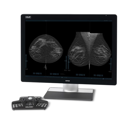 Technologie d’imagerie 3DQuorum™ d’Hologic sur fond blanc.