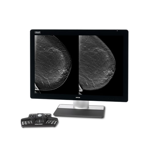 Imagerie synthétique 2D Intelligent 2D™ d’Hologic sur fond blanc