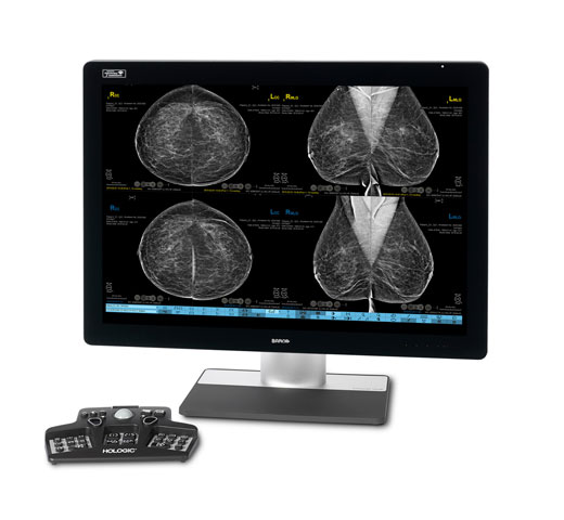 Poste de travail d’imagerie mammaire SecurView® d’Hologic sur fond blanc