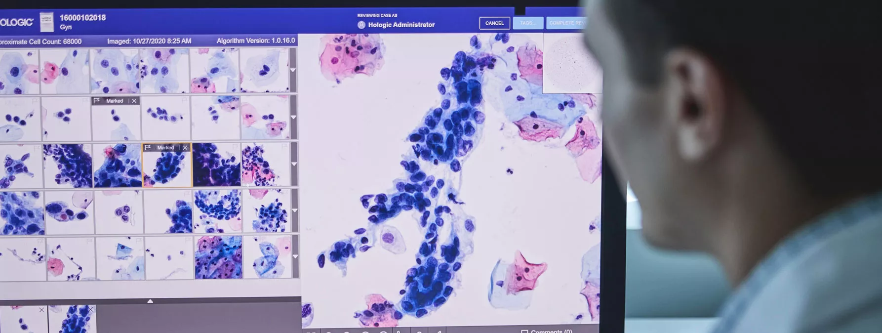 Image du Genius™ Digital Diagnostics System