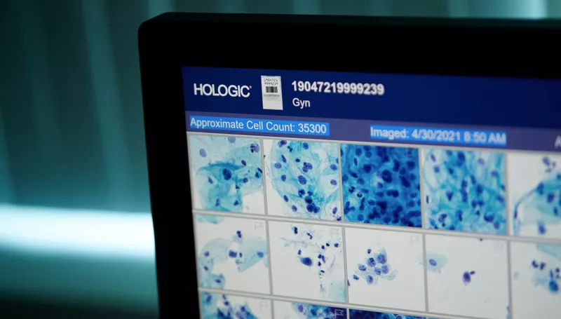 imagerie médicale sur écran d'ordinateur