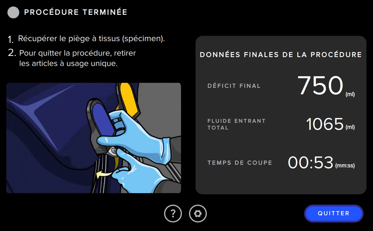 Illustration de l’écran Fluent Pro présentant le résumé de la procédure.