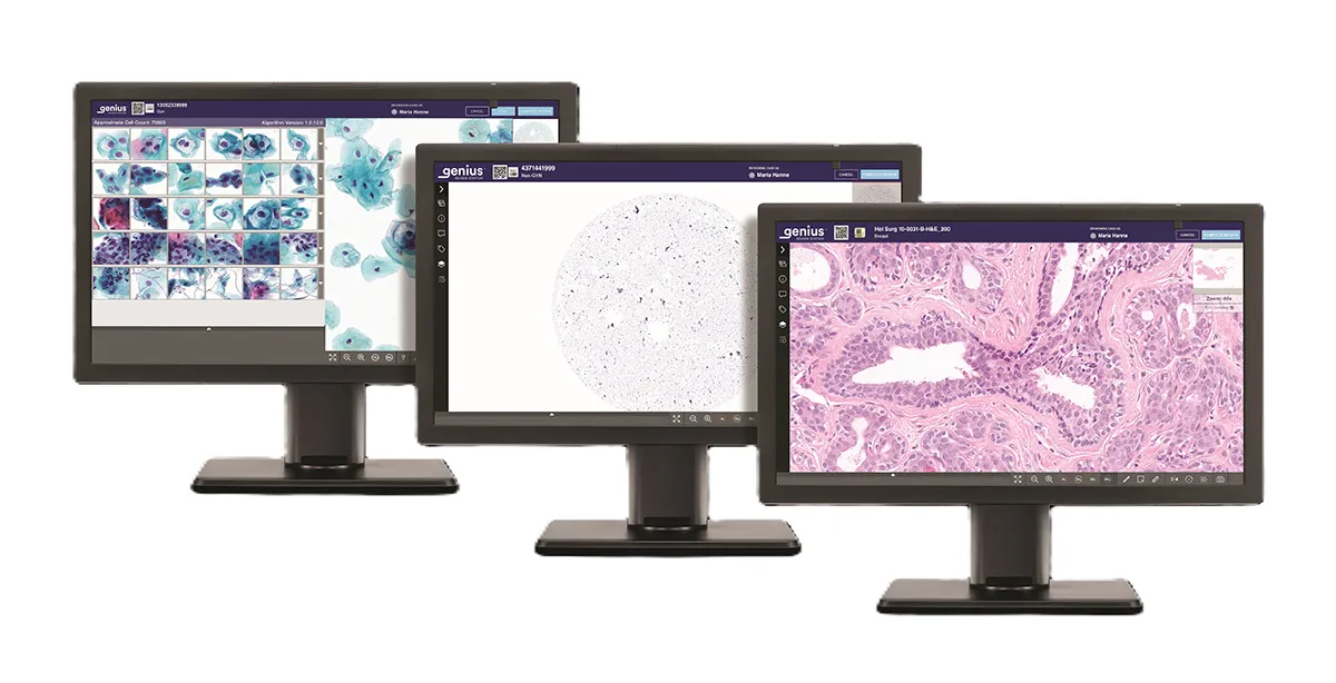 Genius Review Station présentant différents types d’échantillons (gynécologiques, non gynécologiques et histologiques)