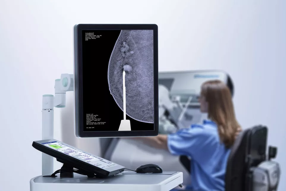 Mammographie 3D avec rehaussement de contraste sur un écran d’ordinateur