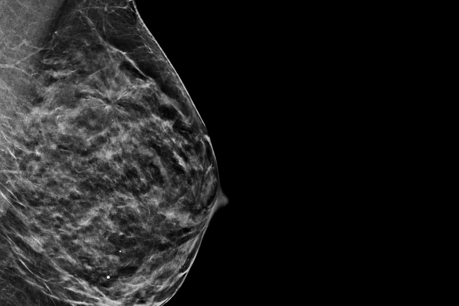 Image radiographique d’un sein sur fond noir