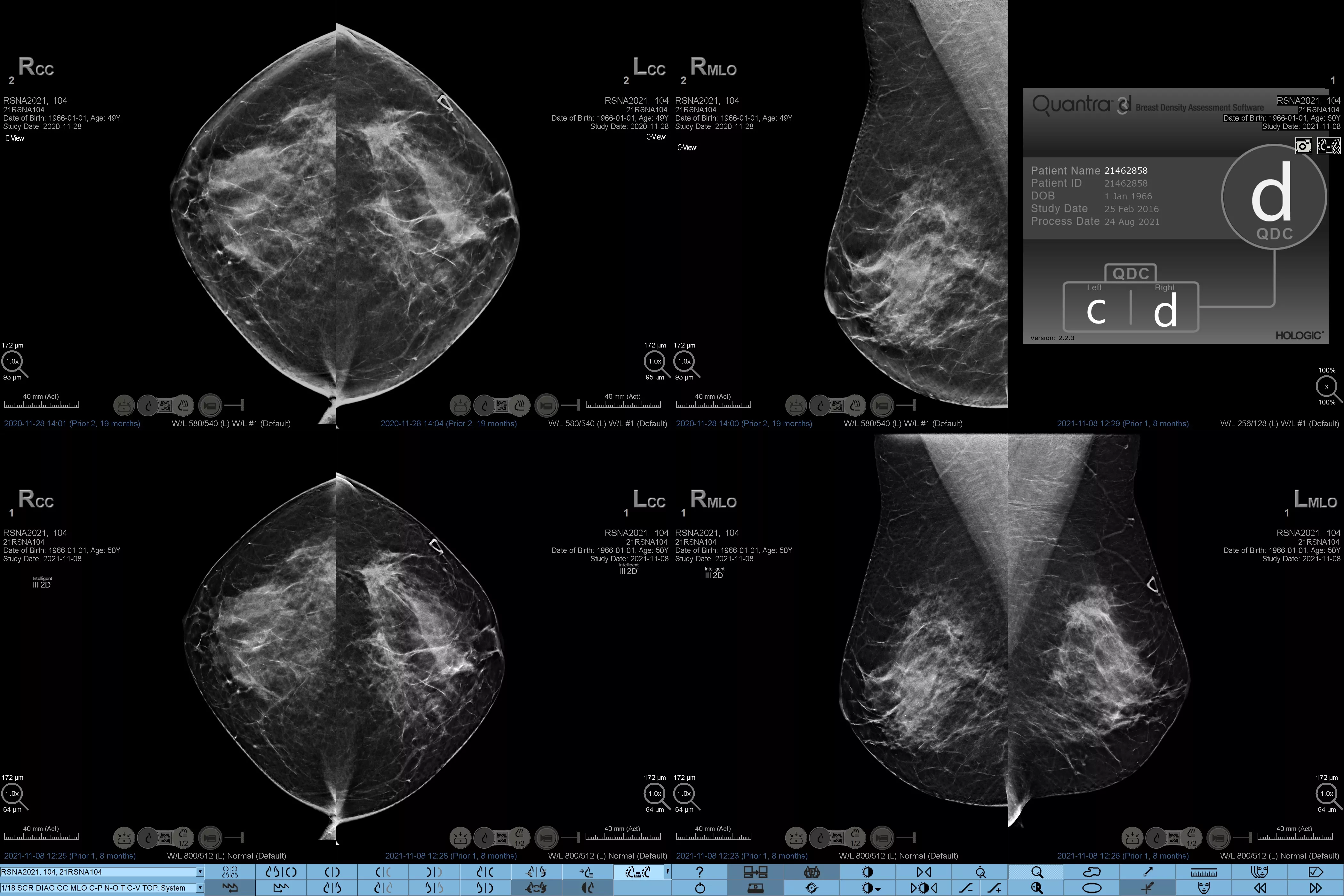Image de radiographie