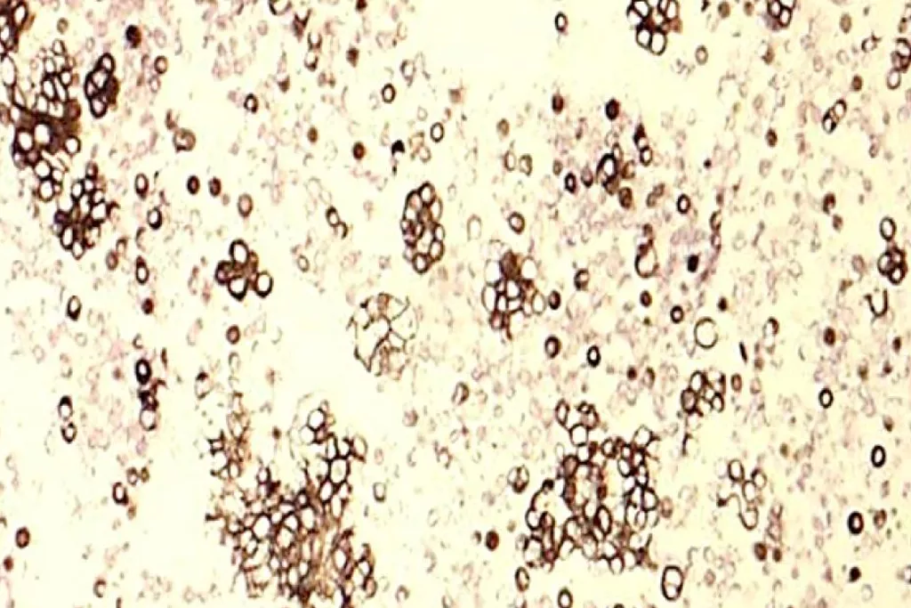 Cytokératine 7​