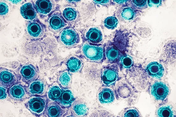 Recherche de virus