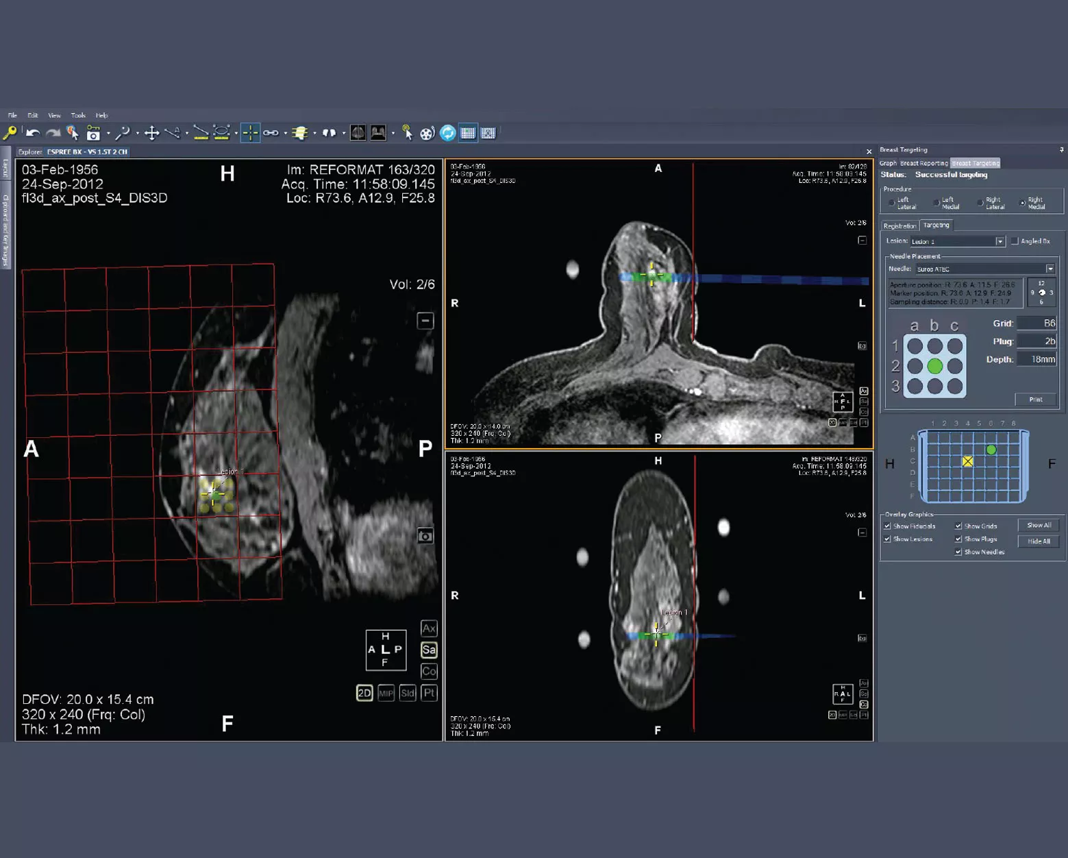 Capture d’écran MultiView
