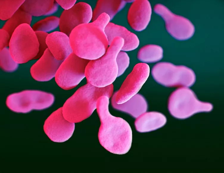 Image d’une infection