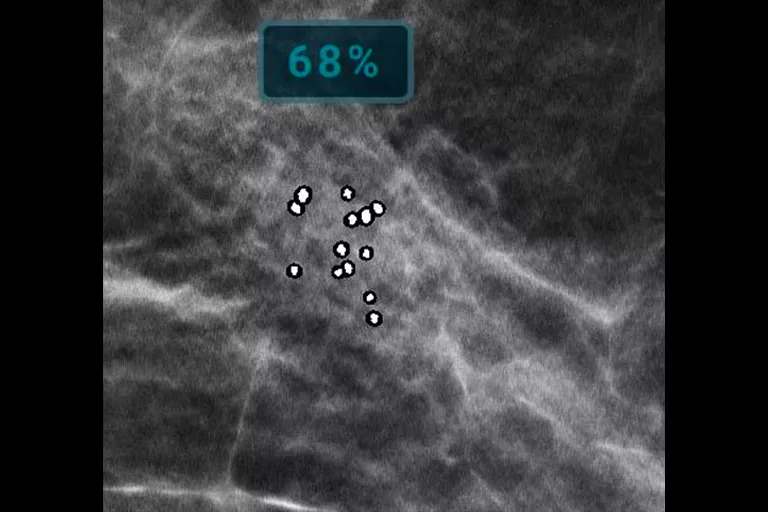 image de radiographie