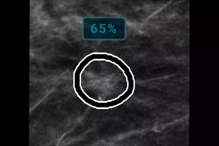 image de radiographie