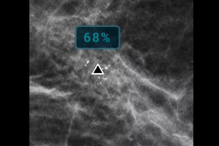 image de radiographie