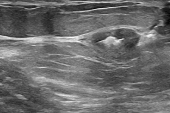 Image échographique et radiographique