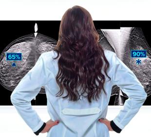 Technologie de détection Genius AI™ d’Hologic sur fond blanc