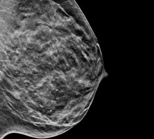 Imagerie 2D synthétique C-View™ d’Hologic sur fond blanc